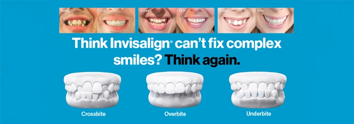 Invisalign banner showing before and after smiles
